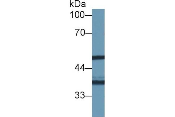 NAT1 抗体  (AA 9-254)