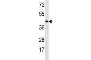Western Blotting (WB) image for anti-Rhodopsin (RHO) (AA 310-339) antibody (ABIN3032473)