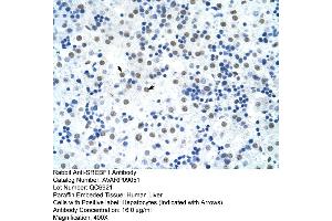 Human Liver (SREBF1 抗体  (Middle Region))