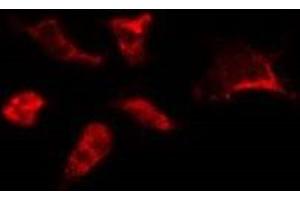 ABIN6278190 staining HepG2 by IF/ICC. (BORA 抗体  (C-Term))