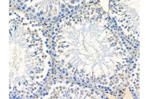 ABIN7094569 and ABIN7098618 at 1/100 staining Rat testis tissue by IHC-P. (Spt6 抗体  (C-Term))