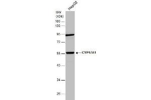 Western Blotting (WB) image for anti-Cytochrome P450, Family 17, Subfamily A, Polypeptide 1 (CYP17A1) (Center) antibody (ABIN2855475)