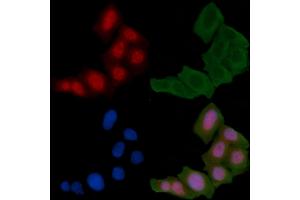 ABIN6255135 and ABIN6267411 staining Hela cells(24h of starvation treatment) by IF/ICC. (JunD 抗体  (pSer255))
