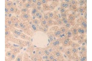Detection of PLXNB1 in Mouse Liver Tissue using Polyclonal Antibody to Plexin B1 (PLXNB1) (PLXNB1 抗体  (AA 1598-1849))