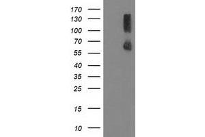 Image no. 1 for anti-Protein Phosphatase, Mg2+/Mn2+ Dependent, 1G (PPM1G) antibody (ABIN1500378) (PPM1G 抗体)