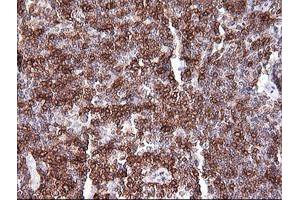 Immunohistochemistry (IHC) image for anti-T-cell surface glycoprotein CD1c (CD1C) antibody (ABIN2670659) (CD1c 抗体)