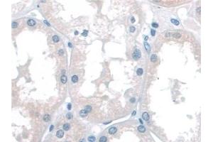Detection of KATNA1 in Human Kidney Tissue using Polyclonal Antibody to Katanin P60 Subunit A 1 (KATNA1) (KATNA1 抗体  (AA 8-229))