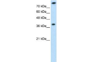 WB Suggested Anti-TST Antibody  Titration: 1 ug/ml Positive Control: Jurkat cell lysate (TST 抗体  (Middle Region))