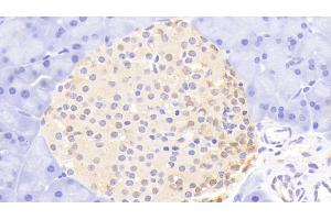 Immunohistochemistry (IHC) image for anti-Ubiquitin Carboxyl-terminal Esterase L1 (Ubiquitin Thiolesterase) (UCHL1) (AA 2-223) antibody (ABIN7440260)