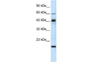 WB Suggested Anti-ZNF24 Antibody Titration:  0. (ZNF24 抗体  (Middle Region))