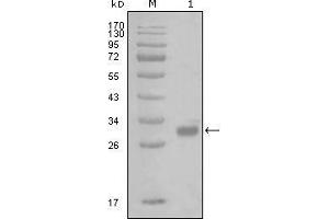 Western blot analysis using PAR1 mouse mAb against truncated GST-PAR1 recombinant protein (1). (PAR1 抗体)