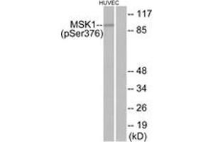 Western blot analysis of extracts from HuvEc cells treated with PMA 125ng/ml 30', using MSK1 (Phospho-Ser376) Antibody. (MSK1 抗体  (pSer376))