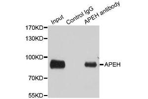 Immunoprecipitation analysis of 100ug extracts of SW480 cells using 3ug APEH antibody. (APEH 抗体  (AA 1-260))