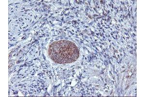 Image no. 2 for anti-1-Acylglycerol-3-Phosphate O-Acyltransferase 5 (Lysophosphatidic Acid Acyltransferase, Epsilon) (AGPAT5) antibody (ABIN1496497) (AGPAT5 抗体)