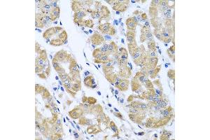 Immunohistochemistry of paraffin-embedded human gastric using EIF2S3 antibody at dilution of 1:100 (x40 lens). (EIF2S3 抗体)