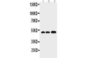 Anti-GFAP antibody, Western blotting All lanes: Anti GFAP at 0. (GFAP 抗体  (C-Term))