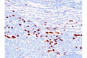 Formalin-fixed, paraffin-embedded human Tonsil stained with Macrophage L1 Protein Mouse Monoclonal Antibody (MAC387) (S100A8 抗体)