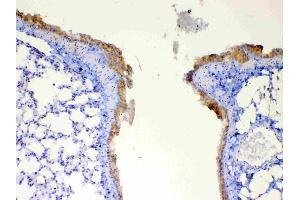 Immunohistochemistry (IHC) image for anti-Dynein, Light Chain, Tctex-Type 1 (DYNLT1) (AA 1-80) antibody (ABIN5693148)