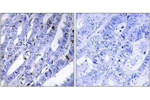 Immunohistochemistry (IHC) image for anti-Protein Kinase, CAMP-Dependent, Regulatory, Type II, beta (PRKAR2B) (AA 79-128) antibody (ABIN1532642)