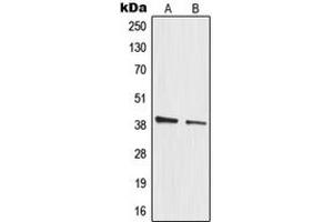 Western blot analysis of MRPL3 expression in HeLa (A), A549 (B) whole cell lysates. (MRPL3 抗体  (Center))