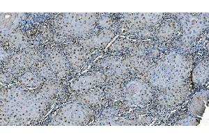 IHC analysis of CDC45L using anti-CDC45L antibody (ABIN7600230).