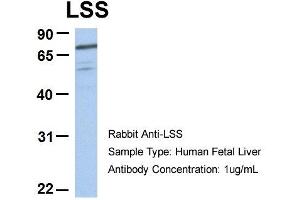 Host:  Rabbit  Target Name:  RIOK3  Sample Type:  Human Fetal Heart  Antibody Dilution:  1. (RIOK3 抗体  (C-Term))
