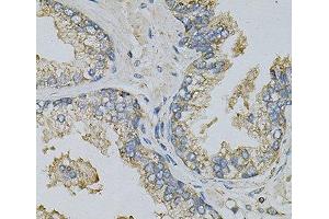 Immunohistochemistry of paraffin-embedded Human prostate using PSAT1 Polyclonal Antibody at dilution of 1:100 (40x lens). (PSAT1 抗体)