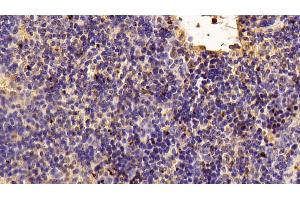 Detection of TIGIT in Mouse Spleen Tissue using Polyclonal Antibody to T-Cell Immunoreceptor With Ig And ITIM Domains Protein (TIGIT) (TIGIT 抗体  (AA 28-246))