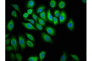 Immunofluorescence staining of A549 cells with ABIN7174093 at 1:100, counter-stained with DAPI. (PTPN13 抗体  (AA 1965-2173))