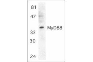 Western blot analysis of MyD88 in Jurkat whole cell lysate with this product at 1:500 dilution.