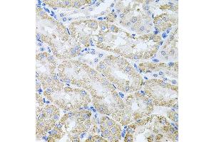 Immunohistochemistry of paraffin-embedded mouse kidney using TARS antibody at dilution of 1:100 (x40 lens).