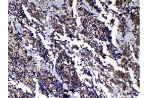 IHC analysis of Ran using anti-Ran antibody . (RAN 抗体  (AA 2-216))