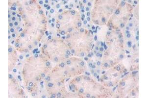 DAB staining on IHC-P; Samples: Rat Kidney Tissue (FLT1 抗体  (AA 303-524))