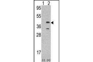 Western blot analysis of MVK (arrow) using rabbit polyclonal MVK Antibody (N-term) (ABIN392802 and ABIN2842240).