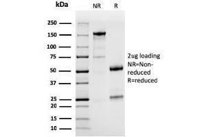 SDS-PAGE (SDS) image for anti-CD274 (PD-L1) (AA 39-191) antibody (ABIN6939571)