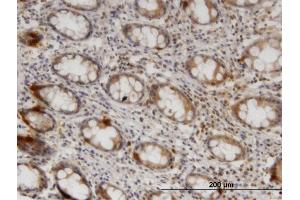 Immunoperoxidase of monoclonal antibody to ZNRF1 on formalin-fixed paraffin-embedded human colon. (ZNRF1 抗体  (AA 74-178))