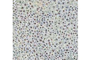 IHC analysis of DCK using anti-DCK antibody (ABIN5693016).