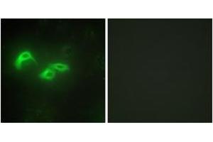 Immunofluorescence analysis of HepG2 cells, using TFAM Antibody. (TFAM 抗体  (AA 131-180))