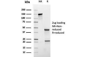 SDS-PAGE Analysis Purified CK20 Mouse Monoclonal Antibody (KRT20/3145).