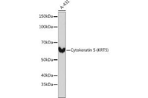 Western blot analysis of extracts of A-431 cells, using Cytokeratin 5 (KRT5) (KRT5) Rabbit mAb (ABIN7268103) at 1:1000 dilution. (Cytokeratin 5 抗体)