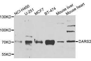 Western blot analysis of extracts of various cells, using DARS2 antibody. (DARS2 抗体)