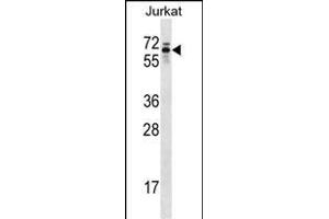 TROVE2 Antibody (C-term) (ABIN1537371 and ABIN2848873) western blot analysis in Jurkat cell line lysates (35 μg/lane).