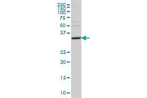 STAU2 monoclonal antibody (M10), clone 2C8 Western Blot analysis of STAU2 expression in SW-13 . (Double-stranded RNA-binding protein Staufen homolog 2 (STAU2) (AA 2-90) 抗体)