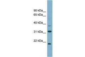 Image no. 1 for anti-N-6 Adenine-Specific DNA Methyltransferase 1 (Putative) (N6AMT1) (N-Term) antibody (ABIN6743395) (N6AMT1 抗体  (N-Term))