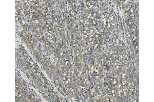 IHC analysis of PPM1E using anti-PPM1E antibody (ABIN7600049).