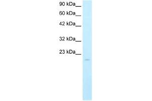 Western Blot showing SP140 antibody used at a concentration of 5. (SP140 抗体  (N-Term))