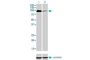 Western blot analysis of MCC over-expressed 293 cell line, cotransfected with MCC Validated Chimera RNAi (Lane 2) or non-transfected control (Lane 1). (MCC 抗体  (AA 31-130))