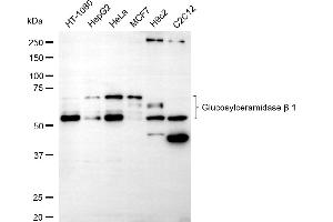 Western blotting analysis using glucosylceramidase beta 1 antibody (ABIN7798736).
