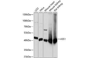 Western blot analysis of extracts of various cell lines, using  antibody  at 1:3000 dilution. (ASS1 抗体  (AA 1-412))