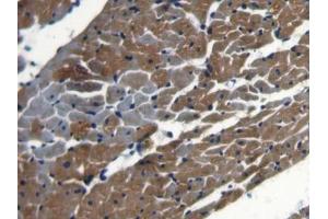 IHC-P analysis of Rat Heart Tissue, with DAB staining. (NCOA3 抗体  (AA 1-269))